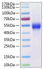 Recombinant Human uPAR/PLAUR/CD87 Protein