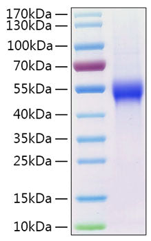 Recombinant Human uPAR/PLAUR/CD87 Protein