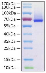 Recombinant Human Glypican-1/GPC1 Protein