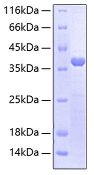 Recombinant Human B7-DC/PD-L2/CD273 Protein