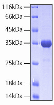 Recombinant Human B7-H1/PD-L1/CD274 Protein