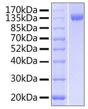 Recombinant Human DNAM-1/CD226 Protein