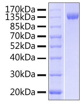 Recombinant Human DNAM-1/CD226 Protein