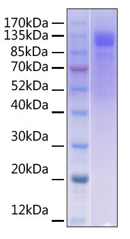Recombinant Human DNAM-1/CD226 Protein