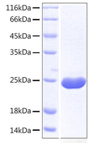 Recombinant Human TACTILE/CD96 (C110S) Protein