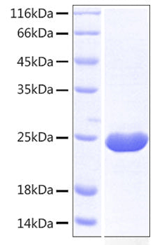 Recombinant Human TACTILE/CD96 (C110S) Protein