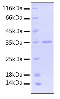 Recombinant Human TACTILE/CD96 Protein