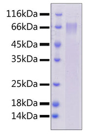 Recombinant Human DLL4 Protein