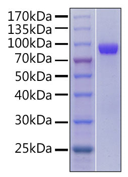 Recombinant Human TNFRSF4/OX40/CD134 Protein