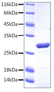 Recombinant Human TNFRSF1B/TNF-R2/CD120b Protein