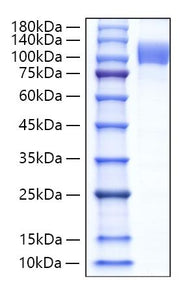 Recombinant Human Follistatin/Follistatin 288/FST Protein