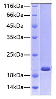 Recombinant Human E-Selectin/SELE/CD62E Protein