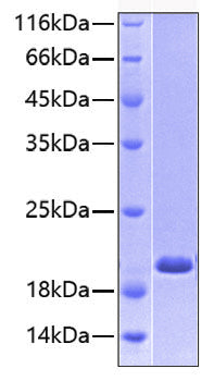 Recombinant Human E-Selectin/SELE/CD62E Protein