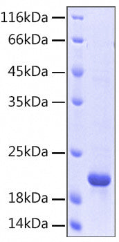 Recombinant Human 5'-Nucleotidase/NT5E/CD73 Protein