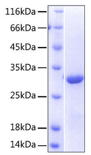 Recombinant Human NKG2-D/KLRK1/CD314 Protein