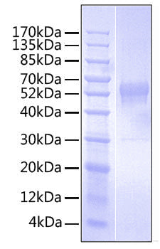 Recombinant Human TROP-2/TACSTD2 Protein