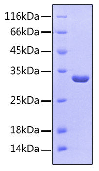 Recombinant Human KLRB1/CD161 Protein