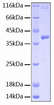 Recombinant Human IL-15RA/CD215 Protein