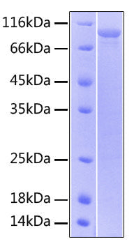 Recombinant Human IL-15RA/CD215 Protein