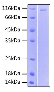Recombinant Human IL-12 R beta 1/CD212 Protein