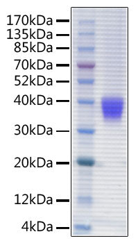 Recombinant Human IL-3RA/CD123 Protein