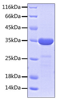 Recombinant Human IL-2 R beta/CD122 Protein