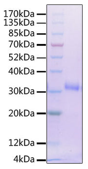 Recombinant Human IL-2 R beta/CD122 Protein