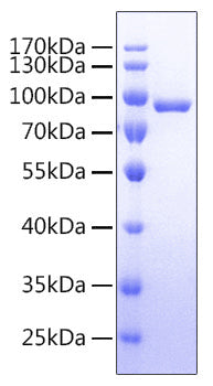 Recombinant Human IL-1R1/CD121a Protein