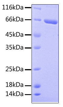 Recombinant Human IL-1R1/CD121a Protein