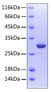 Recombinant Human TNFRSF11A/RANK/CD265 Protein