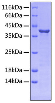 Recombinant Human FLT-3/FLK-2/CD135 Protein