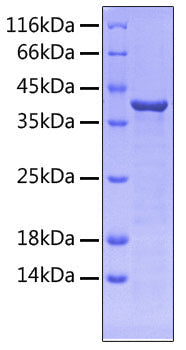 Recombinant Human FLT-3/FLK-2/CD135 Protein