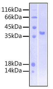 Recombinant Human FGFR-3 beta (IIIb)/CD333 Protein