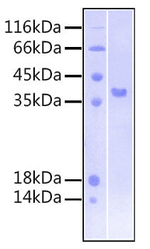 Recombinant Human FGFR-3 beta (IIIb)/CD333 Protein