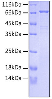 Recombinant Human FGFR-3 alpha (IIIb)/CD333 Protein