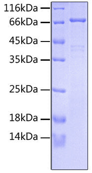 Recombinant Human FGFR-3 alpha (IIIb)/CD333 Protein