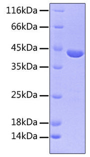 Recombinant Human FGFR-3 beta (IIIc)/CD333 Protein