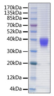 Recombinant Human FcRn/FCGRT&B2M Protein