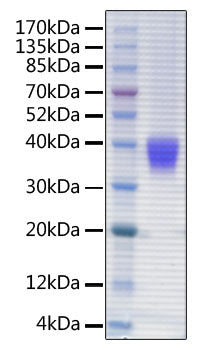 Recombinant Human FcRn/FCGRT&B2M Protein