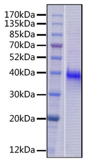 Recombinant Human B7-H3 (4Ig)/B7-H3b/CD276 Protein