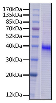 Recombinant Human B7-H3 (4Ig)/B7-H3b/CD276 Protein