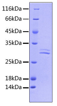 Recombinant Human Fc-gamma RIII beta/FCGR3B/CD16b Protein