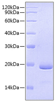 Recombinant Human Fc-gamma RIII beta/FCGR3B/CD16b (S36R, N82D, I106V) Protein