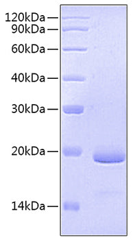 Recombinant Human Fc-gamma RIII beta/FCGR3B/CD16b (S36R, N82D, I106V) Protein