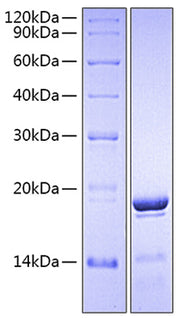 Recombinant Human Fc-gamma RIII alpha/FCGR3A/CD16a (F176V) (107-189) Protein