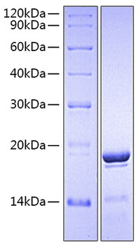 Recombinant Human Fc-gamma RIII alpha/FCGR3A/CD16a (F176V) (107-189) Protein