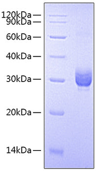 Recombinant Human Fc gamma RIIA/FCGR2A/CD32a (H167R) Protein