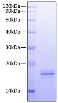 Recombinant Human Fc-epsilon RI-alpha/FCER1A Protein