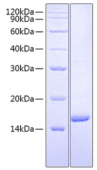 Recombinant Human ErbB-2/HER2/CD340 Protein