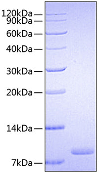 Recombinant Human CSF2RA/GM-CSF R alpha/CD116 Protein